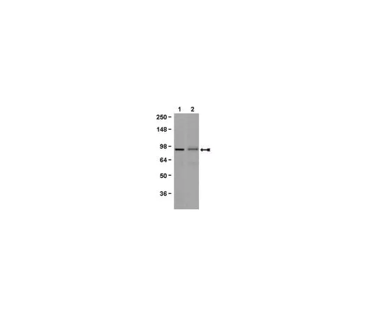 62-8368-99 Anti-Beta Catenin, clone 7F7.2; 100 μg 04-958