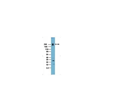62-8389-58 Anti-PEAK1; 200 μl 09-274