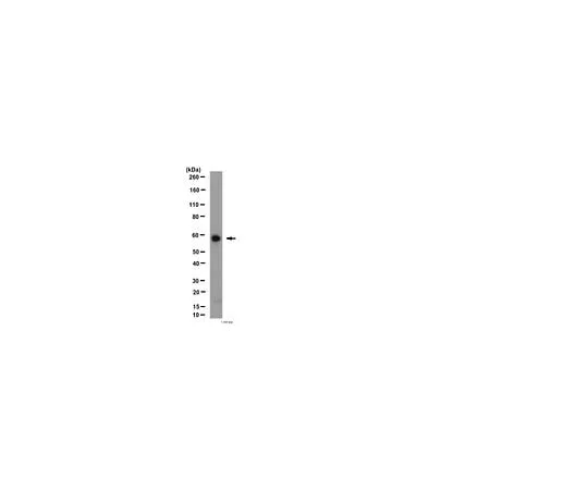 62-8454-45 Anti- Angiopoietin-1; 100 μg AB10516