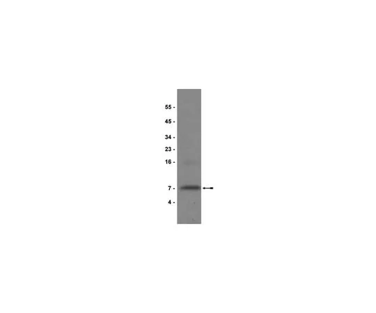 62-8370-50 Anti-IGF-I, clone Sm1.2; 200 μg 05-172