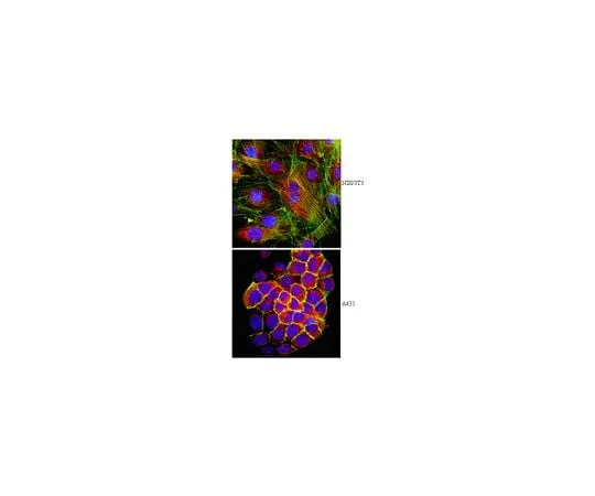 62-8452-29 Anti-F-actin-capping protein subunit beta; 50 μg AB6017