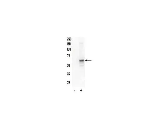 62-8386-61 Anti-phospho-AKT (Thr34); 100 μL 07-789