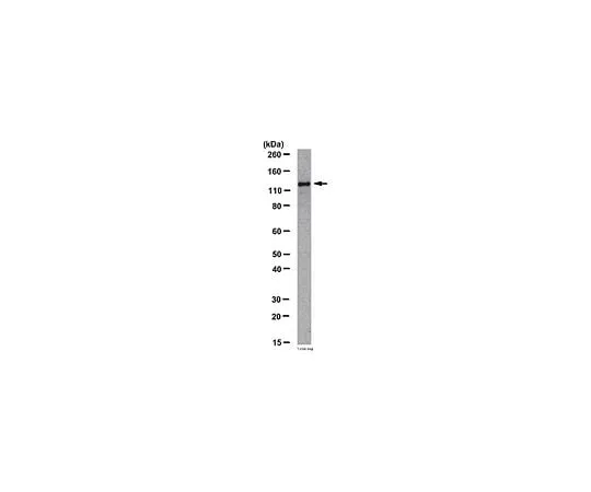 62-8383-16 Anti-JAK2; 100 μg 06-1310