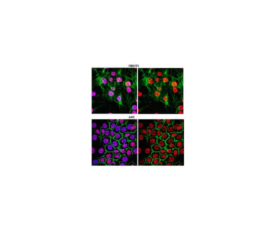 62-8375-51 Anti-trimethyl Histone H3 (Lys27), clone 18E9.1; 100 μL 5-51