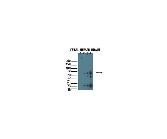 62-8454-97 Anti-zDHHC8;100 μg AB15242