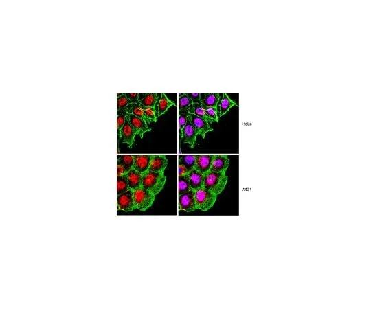62-8388-31 Anti-RAD50; 100 μg 07-1781
