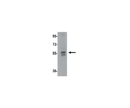 62-8467-84 Anti-NETO1 ABN651