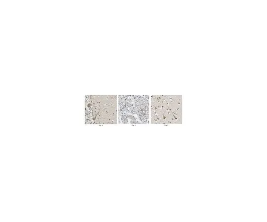 62-8466-95 Anti-MCPH1 ABN404