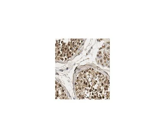 62-8462-80 Anti-FOXM1 ABE1000