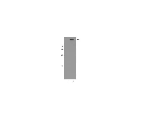 62-8368-25 Anti-phospho-erbB2 (Thr686), clone 7F8; 100 μg 04-293