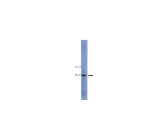 62-8367-81 anti-SOCS1, clone 4H1; 100 μg 04-002