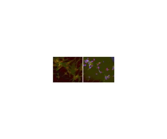62-8464-48 Anti-Fibroblast-specific Protein 1 (S100A4); 100 μg ABF32