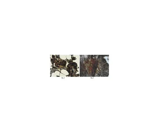 62-8446-91 Anti-MMP-3, N-terminus; 100 μg AB2963