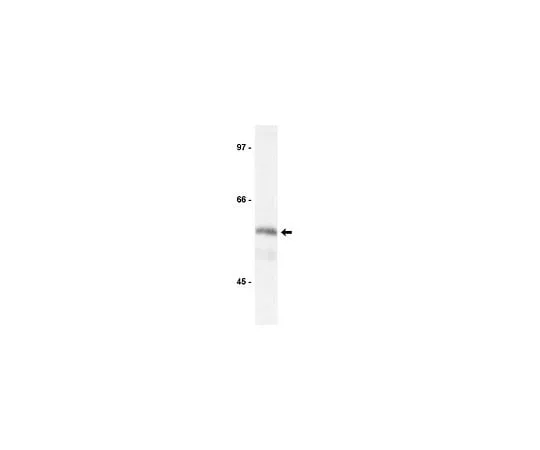62-8381-60 Anti-Kip2; 200 μg 06-556