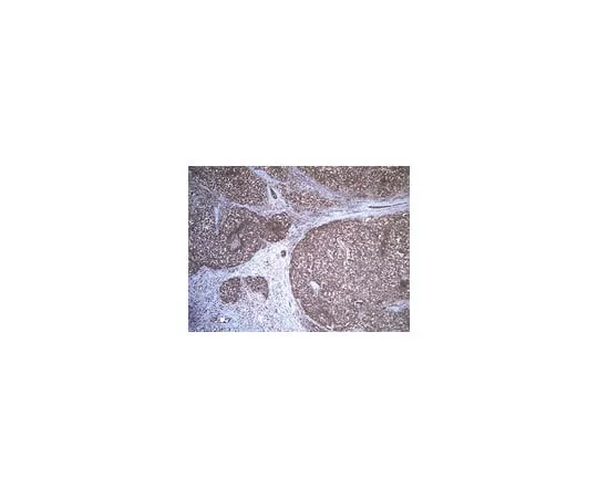 62-8369-04 Anti-Desert hedgehog protein (DHH), clone 19D7.2; 100 μg 04-967