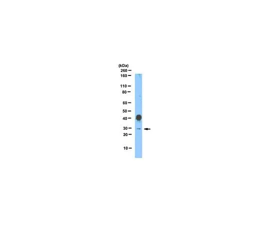 62-8459-51 Anti-SNAI1 (Snail homolog 1); 100 μg ABD38
