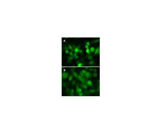 62-8394-41 LentiBrite(TM) GFP-LC3 Control Mutant Lentiviral Biosensor 17-10189