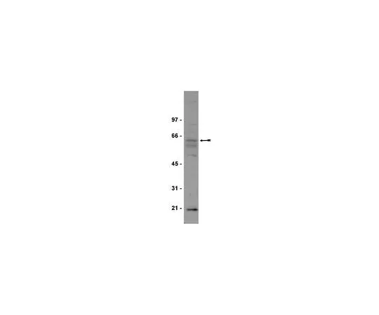 62-8381-31 Anti-Myc; 100 μg 06-340
