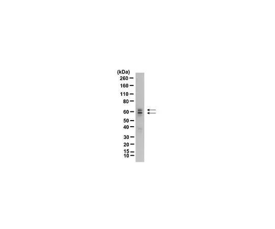 62-8465-77 Anti-GAD65; 100 μg ABN101
