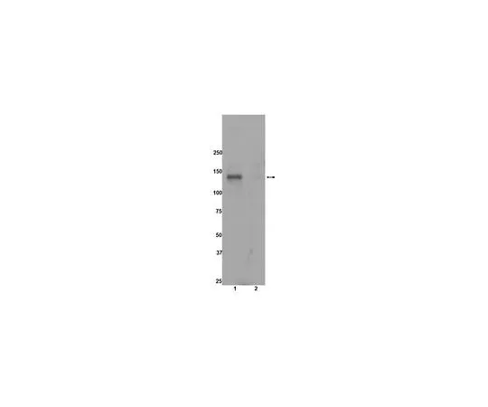 62-8389-37 anti-phospho-ACK1 (Tyr284); 100 μL 09-142