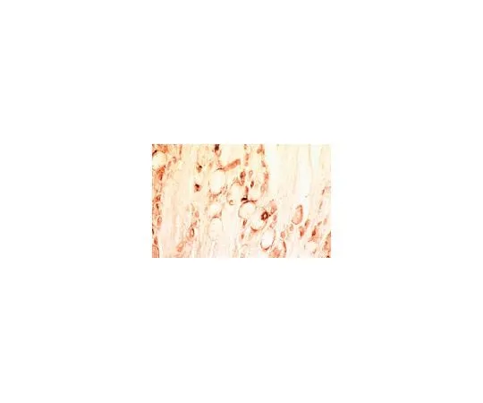 62-8449-60 Anti-Glial Derived Neurotrophic Factor; 50 μg AB5252P