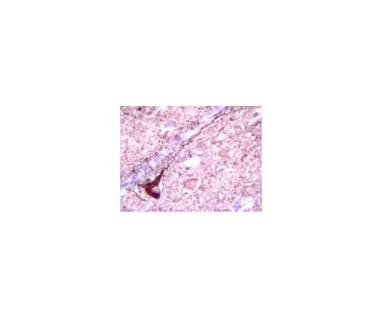 62-8453-35 Anti-Tau phospho Threonine 231; 100 μL AB9668