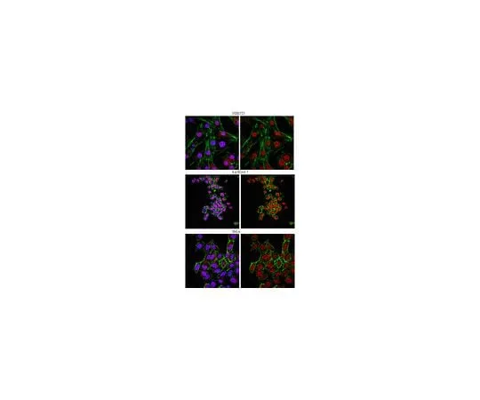 62-8446-69 Anti-FOXP1; 100 μg AB2277