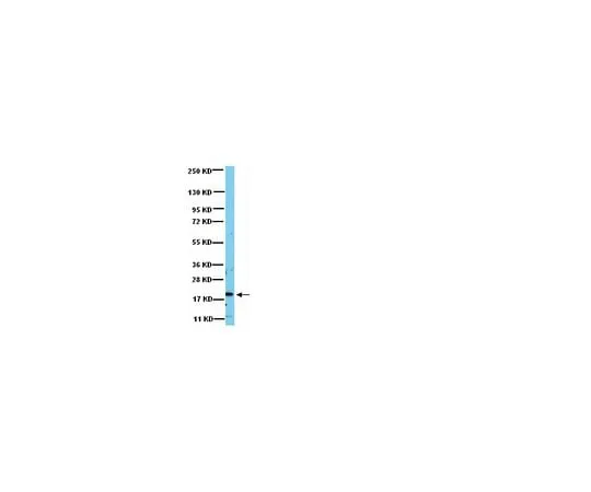 62-8387-75 Anti-RAC1; 100 μg 07-1464