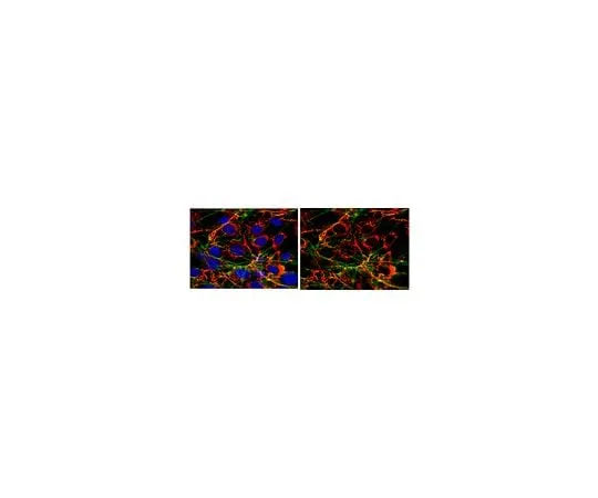 62-8446-23 Anti-Fibronectin; 100 μg AB2033