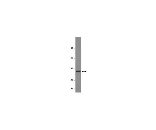 62-8384-42 Anti-PP2A, C subunit; 100 μL 07-324