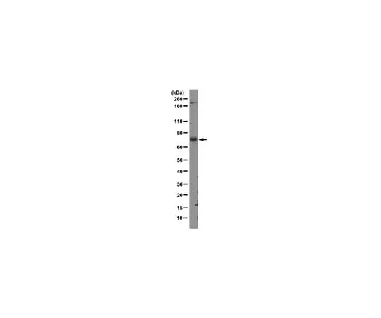 62-8369-33 Anti-MDM2, clone 3G9; 100 μg 04-1530