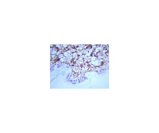 62-8444-46 Anti-Rat Collagen Type I; 100 μg AB755P