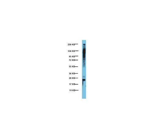 62-8387-77 Anti- Phosphothreonine-Proline; 100 μg 07-1473