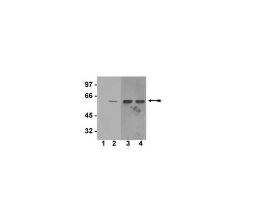 62-8368-43 Anti-phospho-Akt1/PKBα (Ser473), clone SK703; 100 μl 04-736