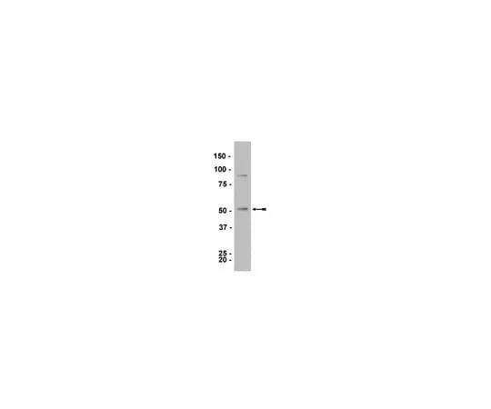 62-8373-33 Anti-LKB1, clone 5c10; 100 μg 05-832