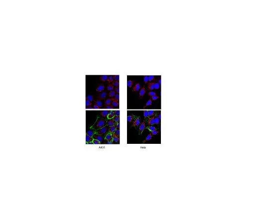 62-8456-24 Anti-ADAM 17; 100 μg AB19027