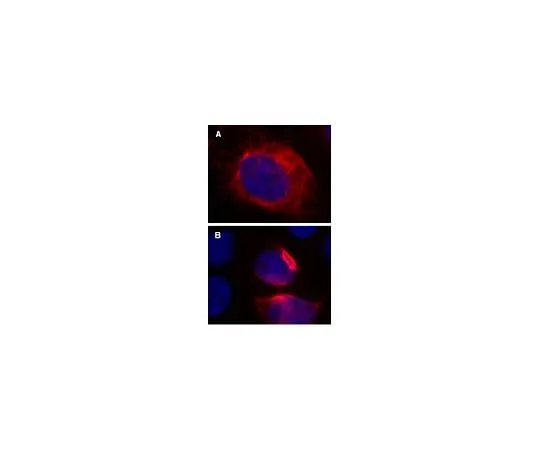 62-8394-36 LentiBrite(TM) RFP-Vimentin Lentiviral Biosensor 17-10153