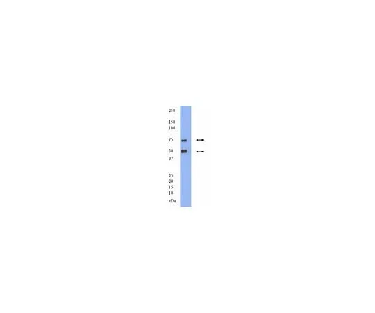 62-8446-46 Anti-Dopamine Transporter; 100 μg AB2231
