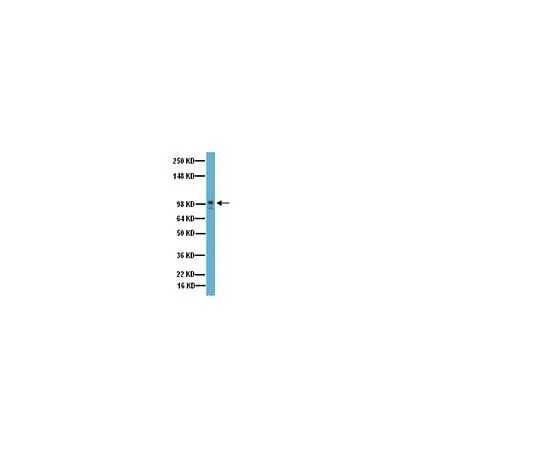 62-8456-21 Anti-MMP-9, Catalytic domain; 100 μg AB19016