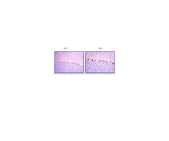 62-8454-68 Anti-LHX2; 100 μg AB10557