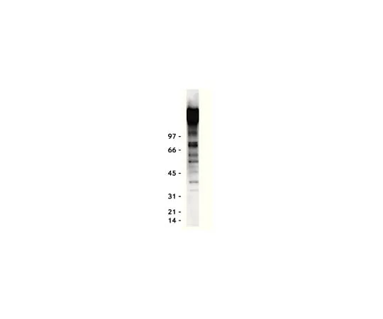 62-8370-75 Anti-Phosphotyrosine, clone 4G10R; 1 mg 05-321MG