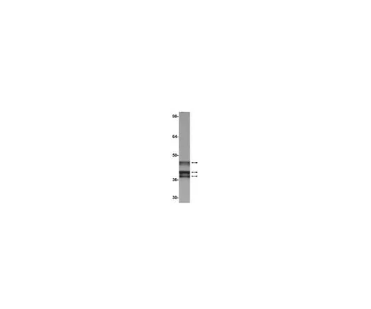 62-8371-93 Anti-E1A (Ad2/Ad5), clone M73; 100 μg 05-599