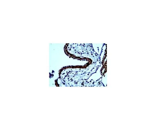 62-8465-58 Anti-Bystin; 100 μg ABN68