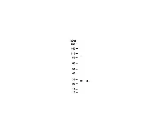 62-8451-77 Anti-Catechol O-methyltransferase/COMT Antibody AB5873-I