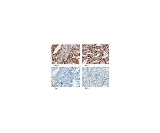 62-8460-96 Anti-EZH1 ABE281