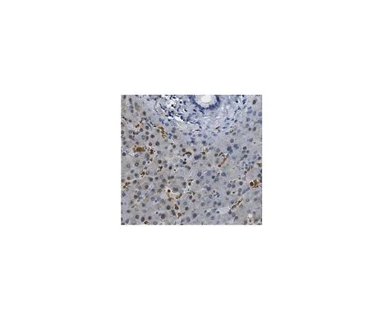 62-8458-24 Anti-Dihydropyrimidine dehydrogenase/DPYD ABC451