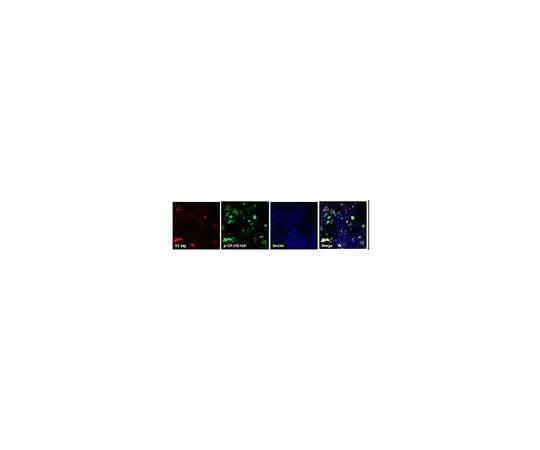 62-8468-17 Anti-C9ORF72/C9RANT (Poly-GP sense/antisense) ABN1358
