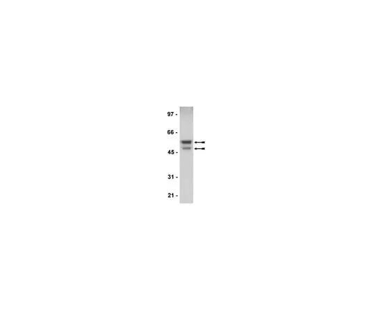 62-8373-63 Anti-GSK3α/β; 100 μL 05-903
