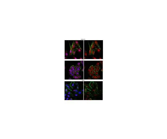 62-8459-97 Anti-Smad4/DPC4; 100 μg ABE21