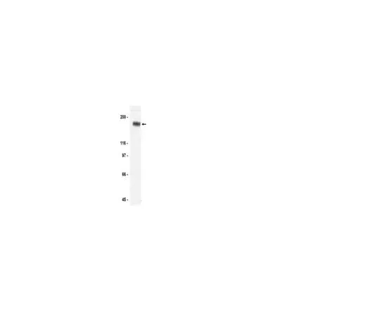 62-8371-04 Anti-erbB-3/HER-3, clone 2F12; 200 μg 05-390